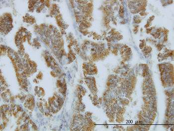 NODAL monoclonal antibody (M03), clone 5C3