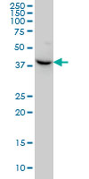 NODAL monoclonal antibody (M03), clone 5C3