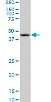 NODAL monoclonal antibody (M03), clone 5C3