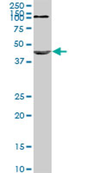 NODAL monoclonal antibody (M03), clone 5C3