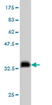 NODAL monoclonal antibody (M03), clone 5C3