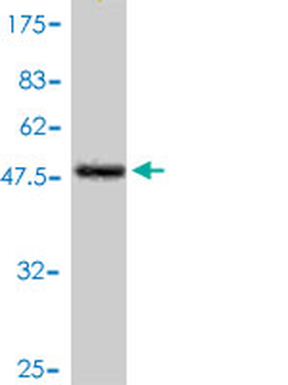 NQO2 polyclonal antibody (A01)