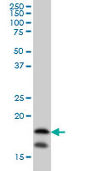 NME2 monoclonal antibody (M08), clone 1F2