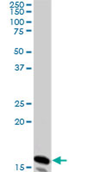NME2 monoclonal antibody (M08), clone 1F2