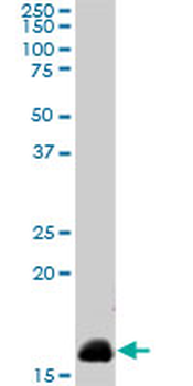 NME2 monoclonal antibody (M08), clone 1F2