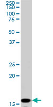 NME2 monoclonal antibody (M08), clone 1F2