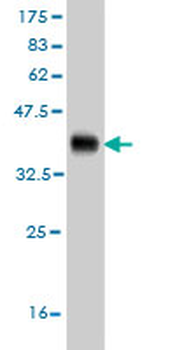 NME2 monoclonal antibody (M08), clone 1F2