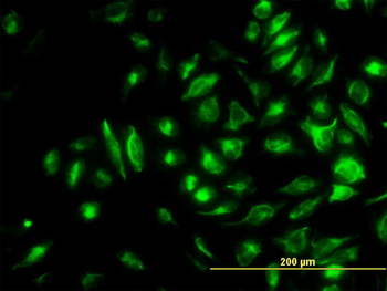 NME2 monoclonal antibody (M06), clone 1D3