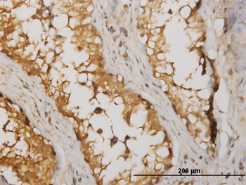 NME2 monoclonal antibody (M06), clone 1D3