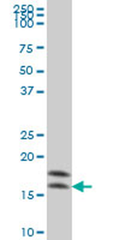 NME2 monoclonal antibody (M06), clone 1D3