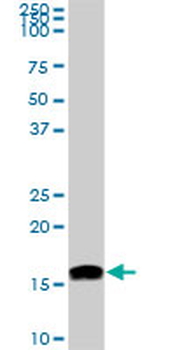 NME2 monoclonal antibody (M06), clone 1D3