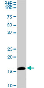 NME2 monoclonal antibody (M06), clone 1D3