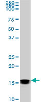 NME2 monoclonal antibody (M06), clone 1D3