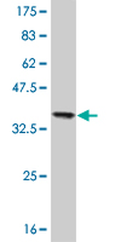 NME2 monoclonal antibody (M06), clone 1D3