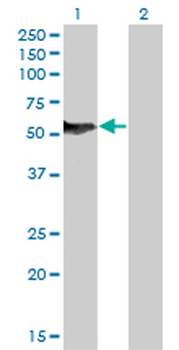 NFIB monoclonal antibody (M08), clone 2D6