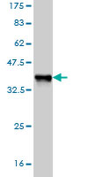 NFE2L2 monoclonal antibody (M03), clone 1B8