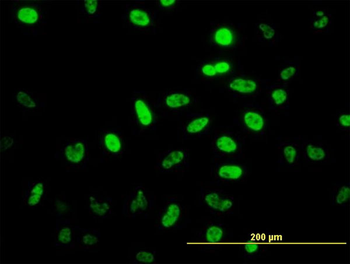 NEUROD1 monoclonal antibody (M01), clone 3H8