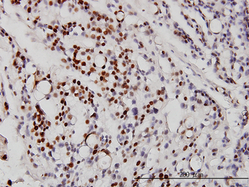 NEUROD1 monoclonal antibody (M01), clone 3H8