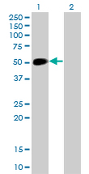 NEUROD1 monoclonal antibody (M01), clone 3H8