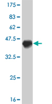 NEUROD1 monoclonal antibody (M01), clone 3H8