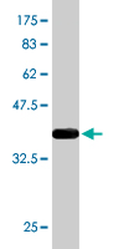 NEDD9 monoclonal antibody (M01), clone 1B4