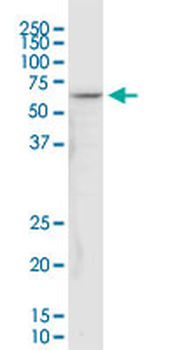 NDUFV1 monoclonal antibody (M01), clone 4A7