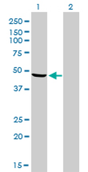 NDUFV1 monoclonal antibody (M01), clone 4A7