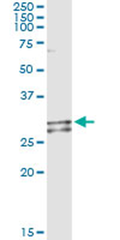 NDUFS3 monoclonal antibody (M02), clone 1D6