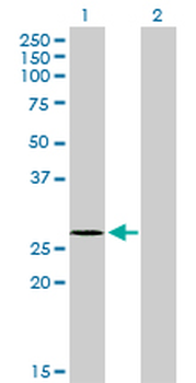 NDUFS3 monoclonal antibody (M02), clone 1D6