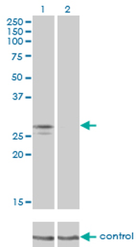 NDUFS3 monoclonal antibody (M02), clone 1D6