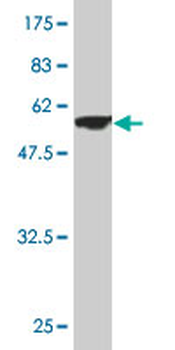 NDUFS3 monoclonal antibody (M02), clone 1D6