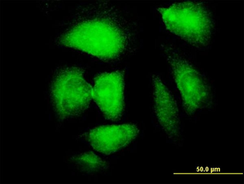 NDN monoclonal antibody (M02), clone 1B3