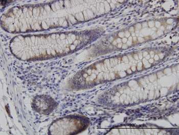 NDN monoclonal antibody (M02), clone 1B3