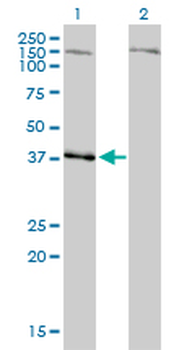 NDN monoclonal antibody (M02), clone 1B3