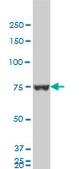 HNRPM monoclonal antibody (M03), clone 3F7