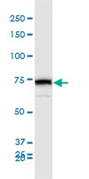 HNRPM monoclonal antibody (M03), clone 3F7
