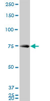 HNRPM monoclonal antibody (M03), clone 3F7