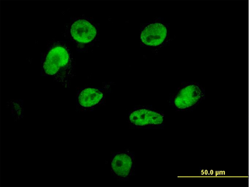 HNRPM monoclonal antibody (M03), clone 3F7