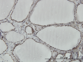 HNRPM monoclonal antibody (M03), clone 3F7