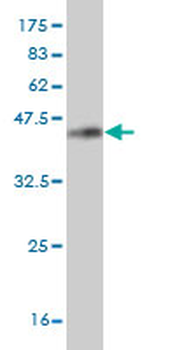 HNRPM monoclonal antibody (M03), clone 3F7