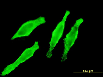 MYL2 monoclonal antibody (M01), clone 3B9-B4