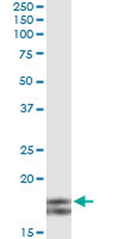 MYL2 monoclonal antibody (M01), clone 3B9-B4