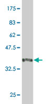 MYL2 monoclonal antibody (M01), clone 3B9-B4