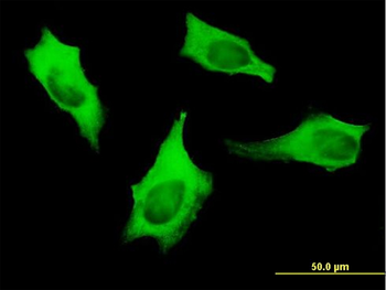 MYH9 monoclonal antibody (M06), clone 4H3