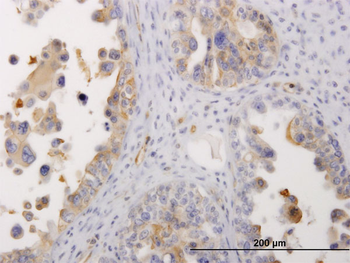 MYH9 monoclonal antibody (M06), clone 4H3