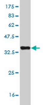 MYH9 monoclonal antibody (M06), clone 4H3