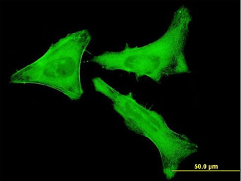 MYH9 monoclonal antibody (M03), clone 2B3
