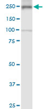 MYH9 monoclonal antibody (M03), clone 2B3