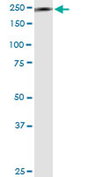 MYH9 monoclonal antibody (M03), clone 2B3