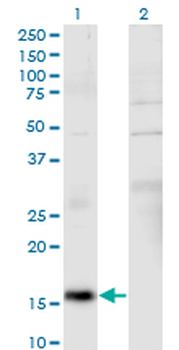 MYH9 monoclonal antibody (M03), clone 2B3